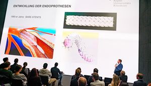 Eindrücke vom "Update Aorta"
